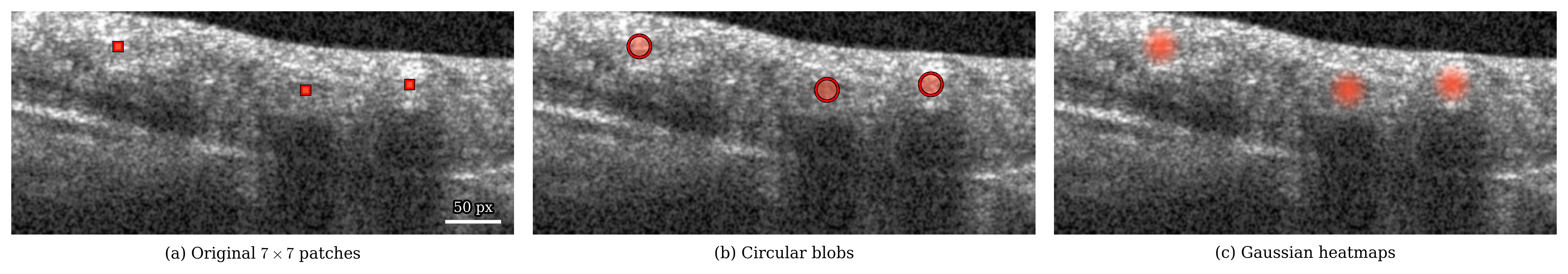 Three annotation formats: original 7x7 patches, circular blobs, and Gaussian heatmaps on OCT B-scans