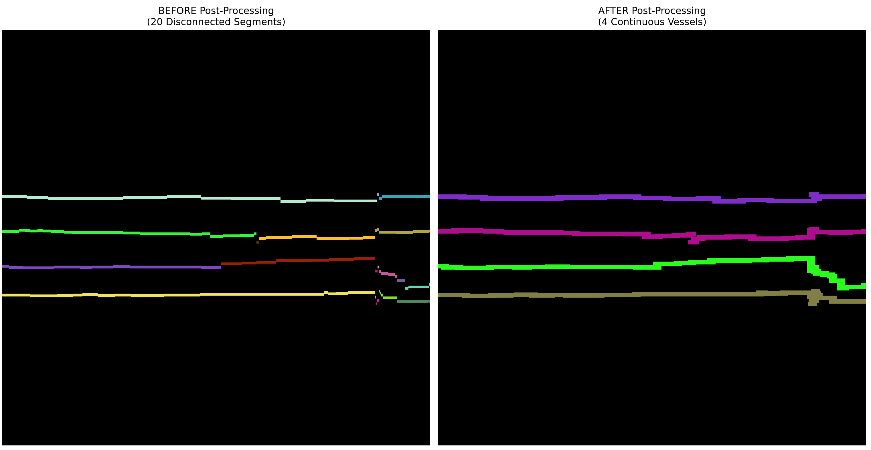 Before and after post-processing: 20 disconnected segments merged into 4 continuous vessels