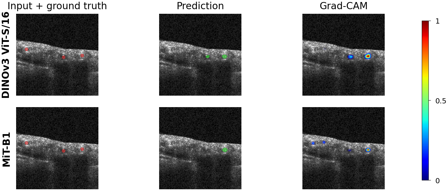 GradCAM comparison between DINOv3 ViT and MiT-B1 showing multi-focal vs single-focal attention patterns