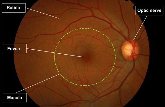 Annotated fundus photograph of the retina showing fovea, macula, optic nerve, and vascular network
