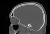 Cracking the bone - Use of forensic data sets to improve bone imaging based on magnetic resonance imaging
