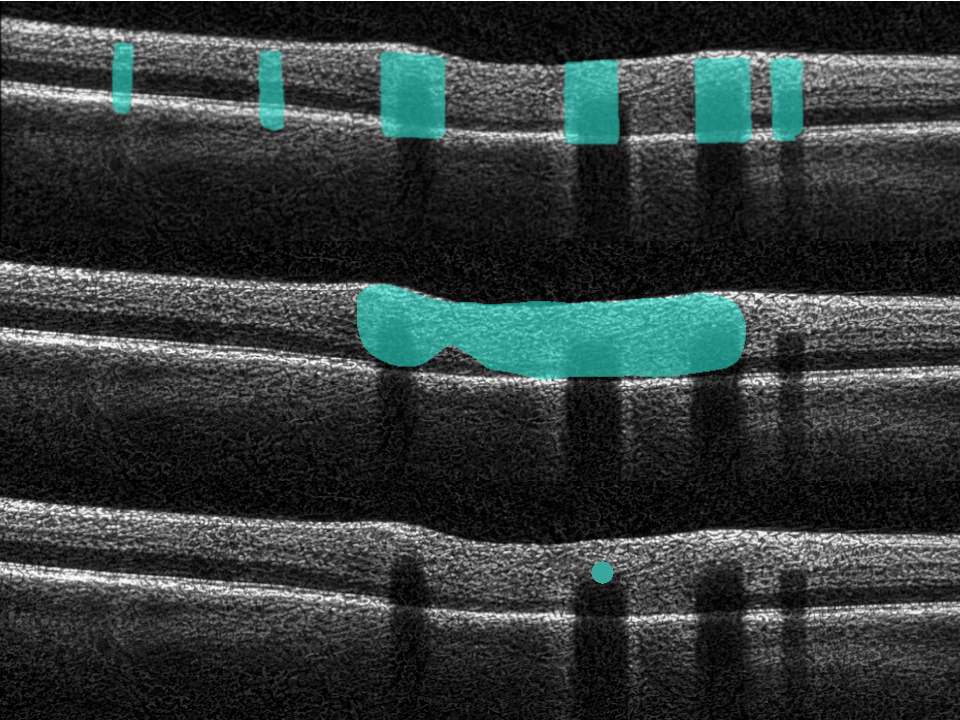 Predicted vessels overlaid on an OCT scan